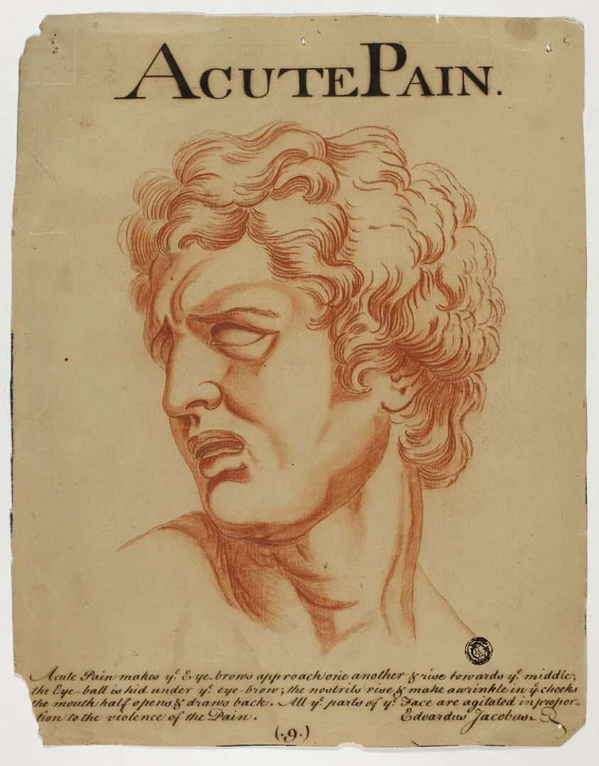 Acute Pain by Eduardus Jacobus, after 1698